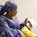 Yüzü tamamen tümörle kaplanmıştı: Kamerunlu çocuk çareyi Türkiye'de buldu