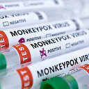 DSÖ maymun çiçeği virüsünün adını 'Mpox' olarak değiştirecek