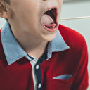 Strep A Enfeksiyonu Nedir, Belirtileri Neler? Bulaşıcı mı?
