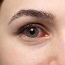 Göz kuruluğuna nedir, göz kuruluğuna ne iyi gelir?