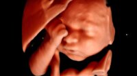 Bilim adamları genlerin tedavi amaçlı düzenlenmesini destekliyor