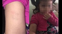 'Baba kolum acıyor geçer mi?' diye sordu gerçek ortaya çıktı