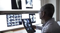 Epilepsi pille kontrol altına alınıyor