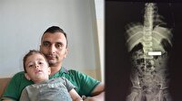 Kumanda pilini göremeyen aile hastaneye koştu