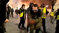 Fransız polisi protestocu gencin parmaklarını kopardı
