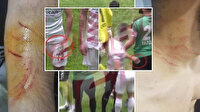 Amedsporlu Mansur Çalar futboldan men edildi