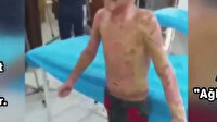 Terör örgütü tişörtü yanıp hastanelik olan çocuğu TSK'nın o hale getirdiğini iddia etti