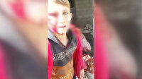 Esed'in bombardımanında yaralanan çocuklar izleyenlerin yüreklerini sızlattı