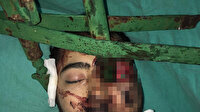 İtfaiye ekibi ve doktorların ameliyathanede birlikte çalışarak yaşama döndürdü hasta yoğun bakımdan çıktı
