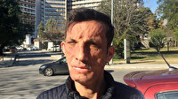 Türkiye'nin ilk yüz nakillisi Uğur Acar: Tek isteğim evlenmek