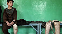 Afganistan'da çocuk olmak: Protez bacağa mahkumsun