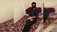 Elektrikle işkence edilen Afganistanlı gencin görüntüleri ortaya çıktı