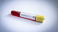 Sağlık Bakanlığı duyurdu: Koronavirüs test sonuçları e-Nabız uygulamasında