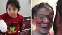 Başıboş köpek dehşeti: 6 çocuğa kabusu yaşattılar
