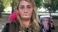 Dolgu yapılan dudağını kaybeden Songül, artık yemek yiyebiliyor