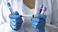 Yeni araştırmada ortaya çıktı: D vitamini eksikliği koronavirüsten ölüm riskini artırabilir