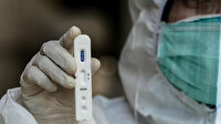 Dünya genelinde koronavirüs bilançosu ağırlaşıyor: Virüs bulaşan kişi sayısı 5 milyon 792 bini aştı
