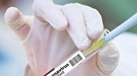 Rusya resmen duyurdu: Koronavirüs aşısının klinik denemeleri tamamlandı