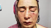 Zorla girdiği evde çocuklarının gözü önünde eşini öldüresiye darp edip pencereden atmaya kalkıştı