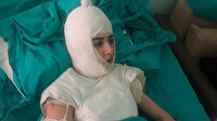 Üvey anne genç kızın başından aşağı kaynar su dökmüştü: Öz anne 4.5 yıla isyan etti, müebbet hapis istedi