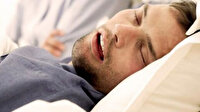Gece boyunca horluyor ya da uyurken nefesiniz mi kesiliyor? Uyku apnesinin belirtileri ve tedavisi