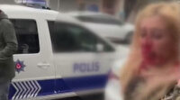Gaziosmanpaşa'da kadına kafa atarak kanlar içinde bıraktı