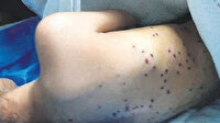 Vücuduna tam 100 saçma isabet etmişti: Magandaya 51 yıl hapis cezası verildi