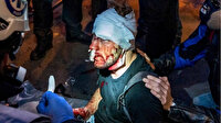 Paris'te polis şiddetine maruz kalan Suriyeli gazeteci Al Halbi o anları anlattı: Polis copla yüzüme vurdu