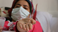 Doktorlar çıkardık demişti: Bebekken yuttuğu iğneden 17 yıl sonra kurtuldu