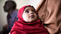 Yeryüzü Doktorları Afrika'daki katarakt projesi: Elimiz tuttuğu müddetçe tüm sıkıntılara göğüs germeye devam edeceğiz