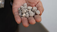 Böbreklerden çıkan taşlar görenleri hayrete düşürüyor: Kimisi 22 santim, kimisi 650 gram!