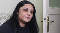 Samsun'da eski eşinin darp ettiği kadın: Şiddet sessiz kalındıkça çoğalıyor