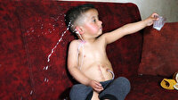 Üç yaşındaki Muhammed ameliyat olmayı bekliyor: Yemek borusu kısa olan Muhammed'in her içtiği boğazından geri dökülüyor