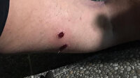 İşgalci İsrail polisi AA muhabirini canlı yayında vurdu