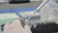 Covid-19'u geçirenlerin PCR testi yapması zorunlu mu?
