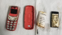 Tıp dünyasını şoke eden ameliyat: Midesinden Nokia 3310 çıktı!