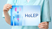 İyi huylu prostat büyümesinde altın standart tedavi: HoLEP