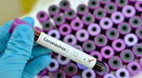 Covid-19'un Omicron varyantının semptomları açıklandı