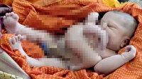 Dört kolla ve dört bacakla dünyaya geldi: Bir ülke bebeği görmek için sıraya girdi