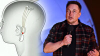 Elon Musk'ın çılgın projesi gerçek oluyor: İnsan beynine çip takacak