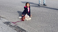 10 yaşındaki Mahra köpekten kaçarken kamyonun altında kalmıştı: Yoğun bakıma alındı durumu ciddi