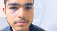 Araplara sokak ortasında dayak: 'Bunu hak etmedik'