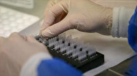 DSÖ'den 'gizemli hepatit' açıklaması