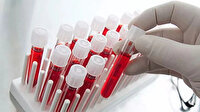 Araştırma yayımlandı: Felce en yatkın kan grubu açıklandı