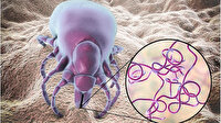 Ölümcül bakteri sonunda Türkiye'de de görüldü: Uzmanlardan korkutan yeni salgın uyarısı