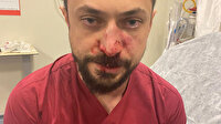 Şanlıurfa’da saldırıya uğrayan doktorun burnu kırıldı