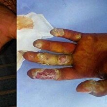 Çektiği tespih hayatını kararttı: Tüm mahalle karantinaya alındı