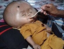 Pakistanlı bebeğin yürekleri burkan hikayesi