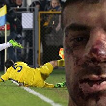 Ünlü futbolcuyu tekme tokat dövdüler: Tanınmayacak halde