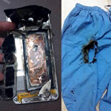 Zonguldak’ta muayene sırasında doktorun telefonu patladı